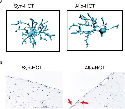 Acute Graft-Versus-Host Disease, Infections, Vascular Events and Drug Toxicities Affecting the Central Nervous System